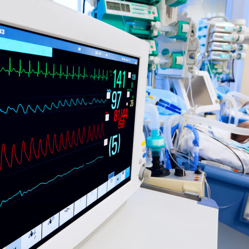 اسرة عنايه مركزة – مجهزة بأجهزة تنفس صناعى