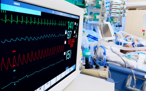 Pediatric ICU with ECG monitor on foreground اسرة عنايه مركزة – مجهزة بأجهزة تنفس صناعى