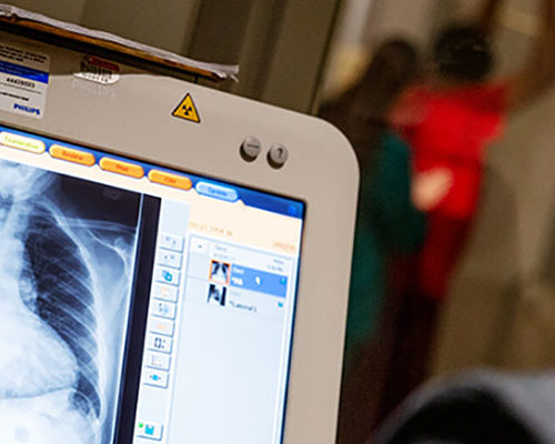 مركز اشعه متكامله الخدمات 24ساعه  ,أشعه مقطعيه – أشعه تلفزيونيه -اشعه عاديه