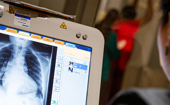 ED-Trauma_a_770-1 مركز اشعه متكامله الخدمات 24ساعه ,أشعه مقطعيه – أشعه تلفزيونيه -اشعه عاديه