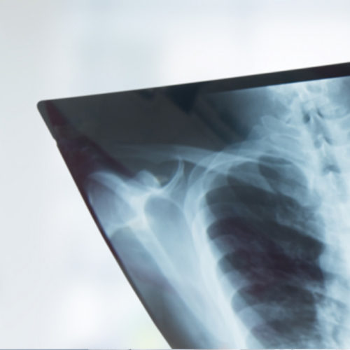 عيادات الاشعه التداخليه و السونار